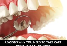 Reasons why you need to take care of your oral cavities