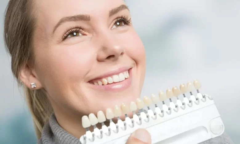 dental veneers in Toronto