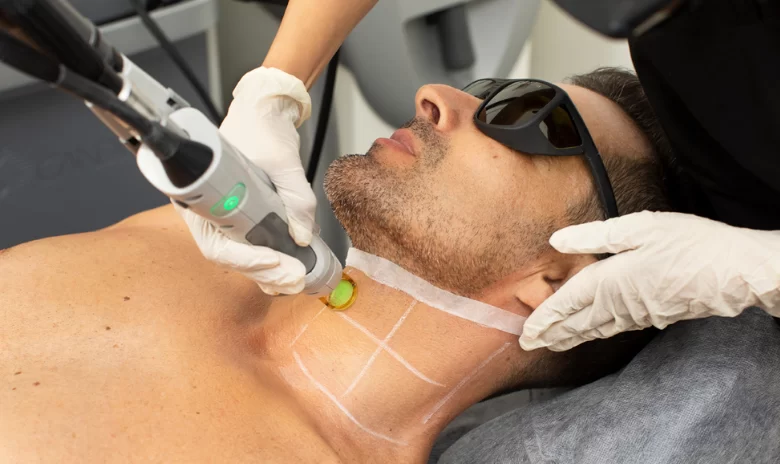 How does laser hair removal treatment works